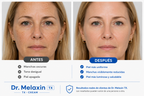 DR MELAXIN TX CREAM + OBSEQUIO